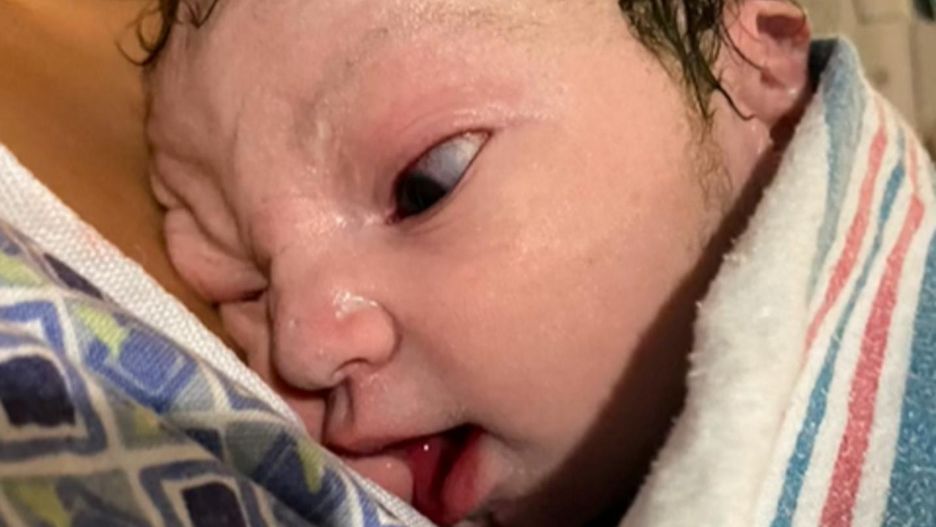 Najbrzydsze dzieci na TikToku. Matki prześcigają się w dziwacznym wyzwaniu