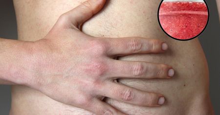 Trzy napoje skutecznie redukują stłuszczenie wątroby. Potwierdzone badaniami