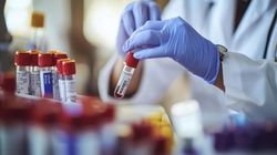 Pacjentów przybywa, hematologów brakuje. Niezbędne rozwiązania systemowe