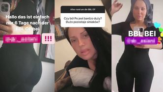 Schwesta Ewa znów powiększyła pośladki. "Winny jest Instagram i TIK TOK, i WSZYSTKO!" (ZDJĘCIA)