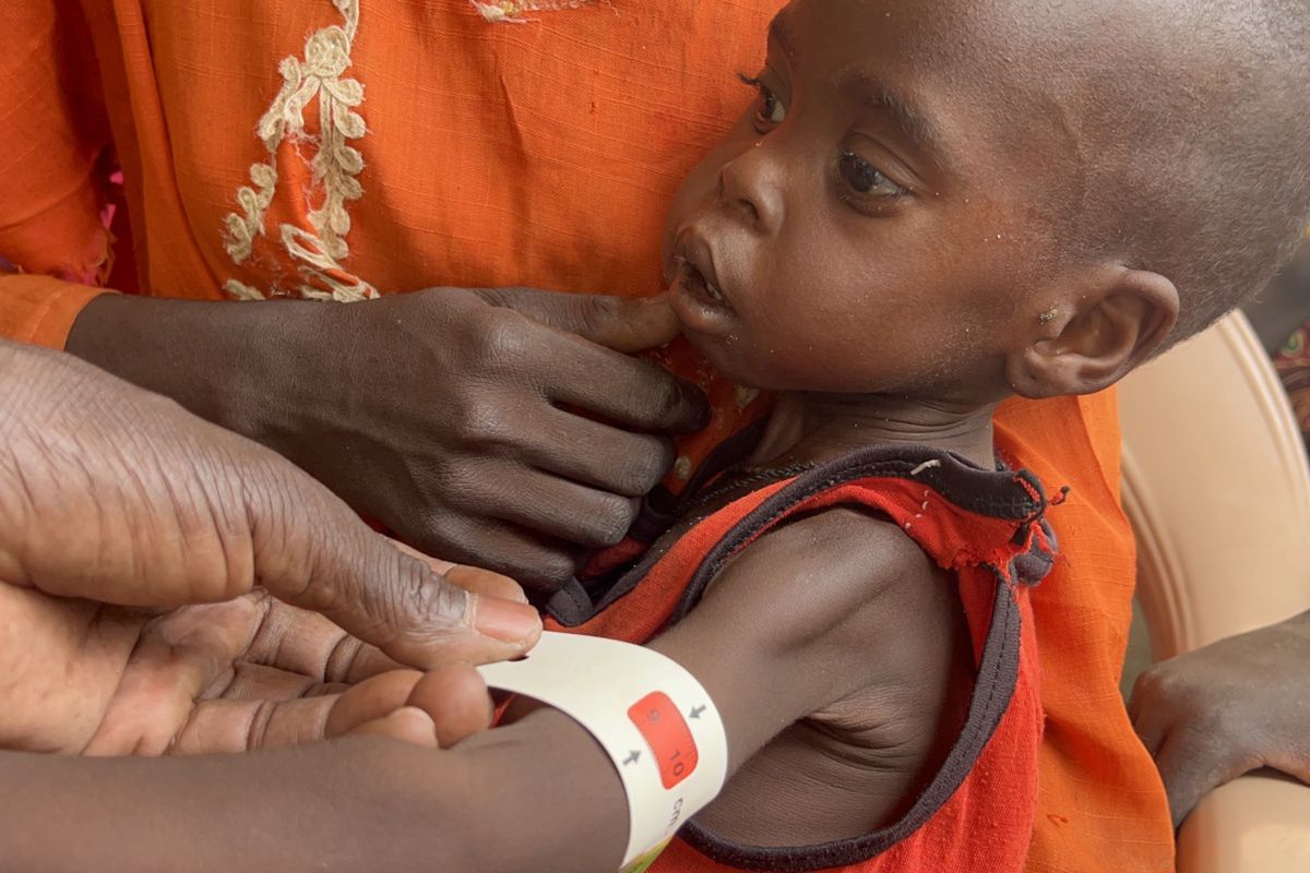 An arm circumference below 11.5 cm indicates malnutrition. Akoot's arm circumference is 9.5 cm.