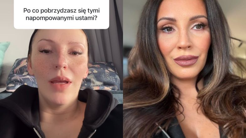 Dominika Serowska zaprzecza, że powiększyła usta