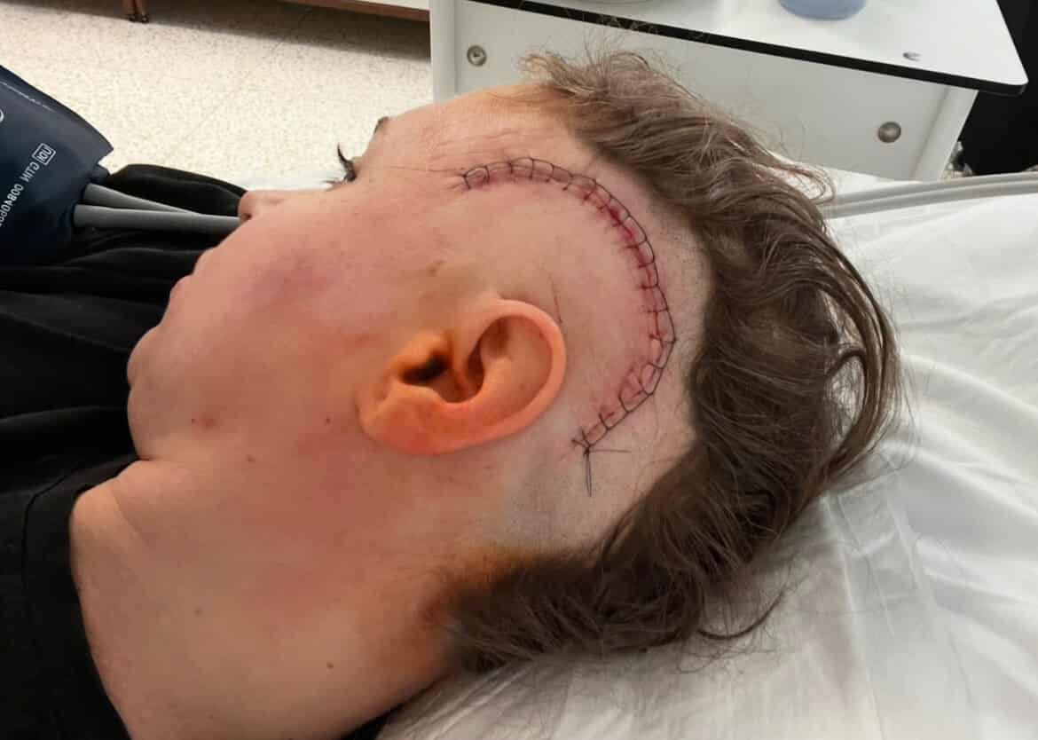 Klaudia po raz drugi walczy z glejakiem