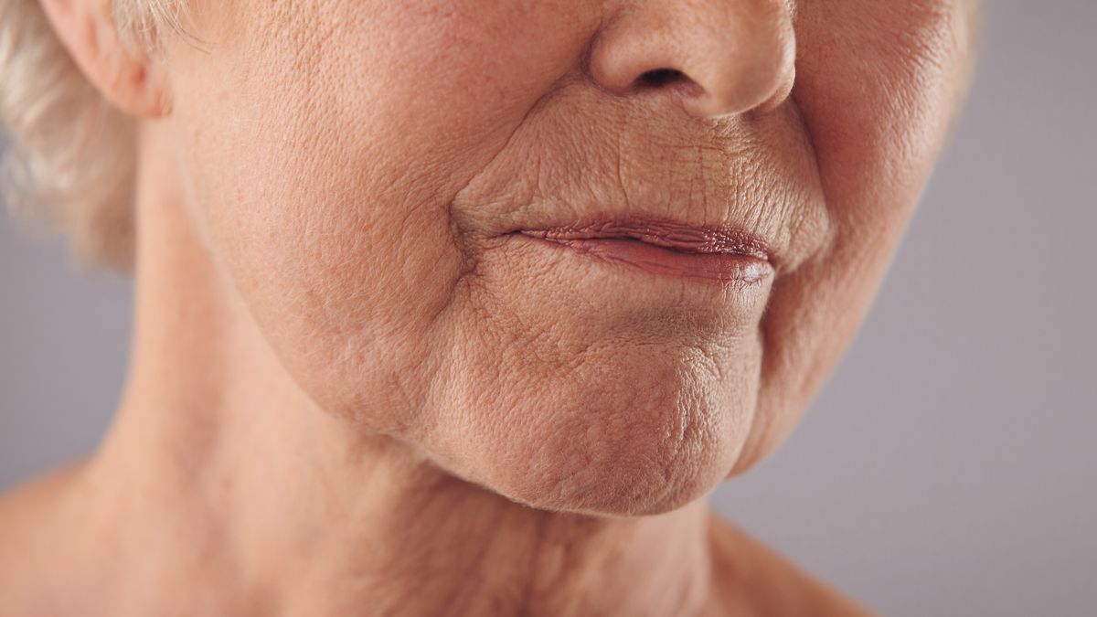 Jak maść z żyworódki działa na skórę? 