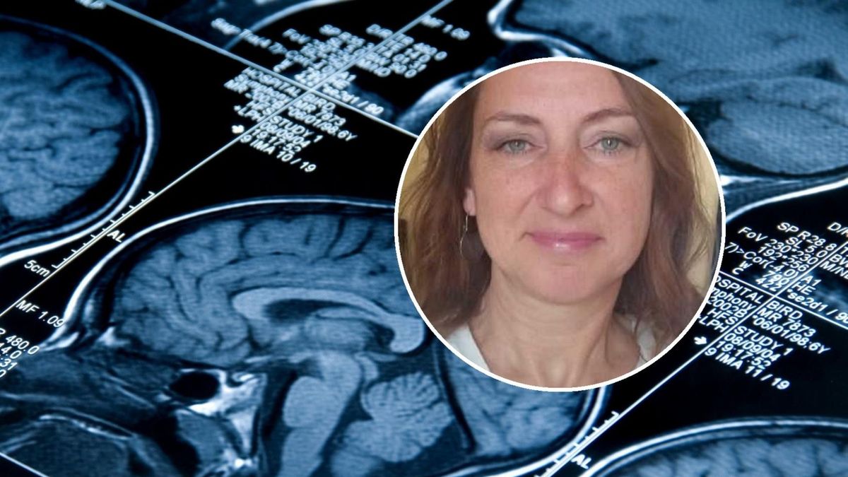 Koronawirus w Polsce. Coraz więcej przypadków niedokrwienia mózgu. Joanna nie spodziewała się takiej diagnozy