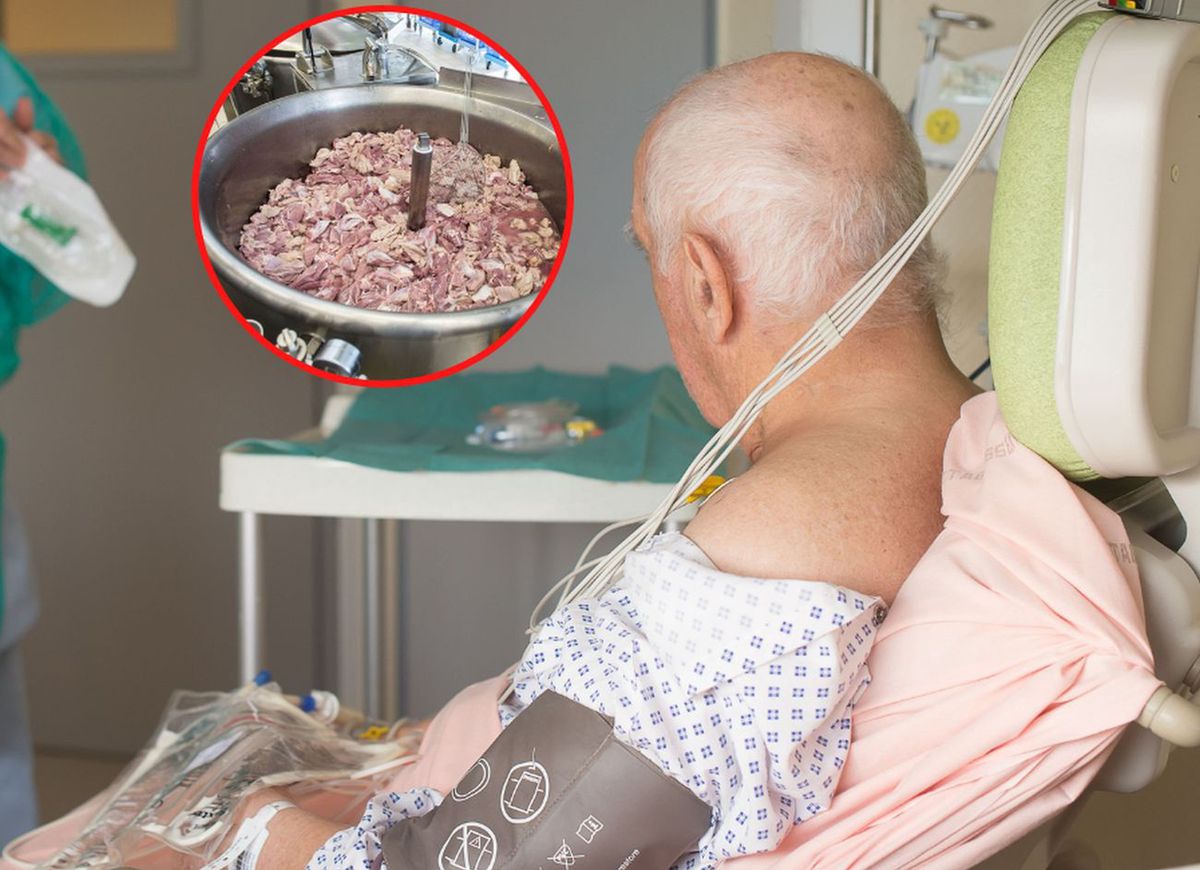 Jarosław Pinkas: "Podczas przygotowywania żywności dla pacjentów onkologicznych nie może dochodzić do jakichkolwiek uchybień "(zdjęcie ilustracyjne)