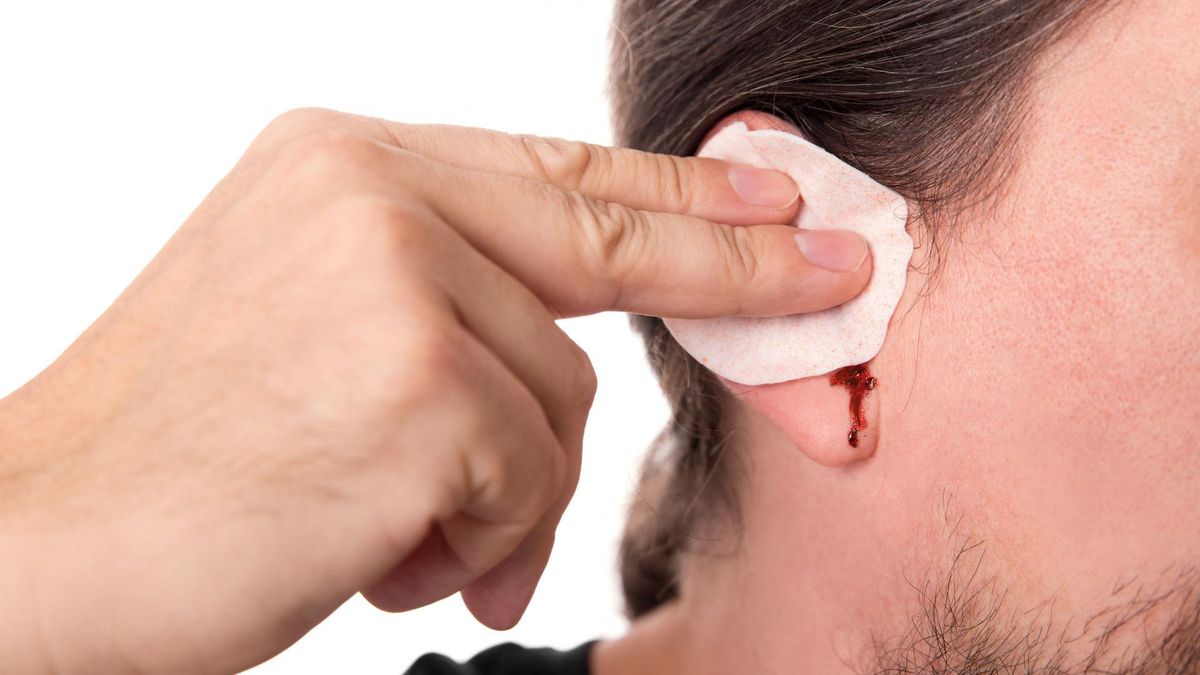 Krwawienie z ucha