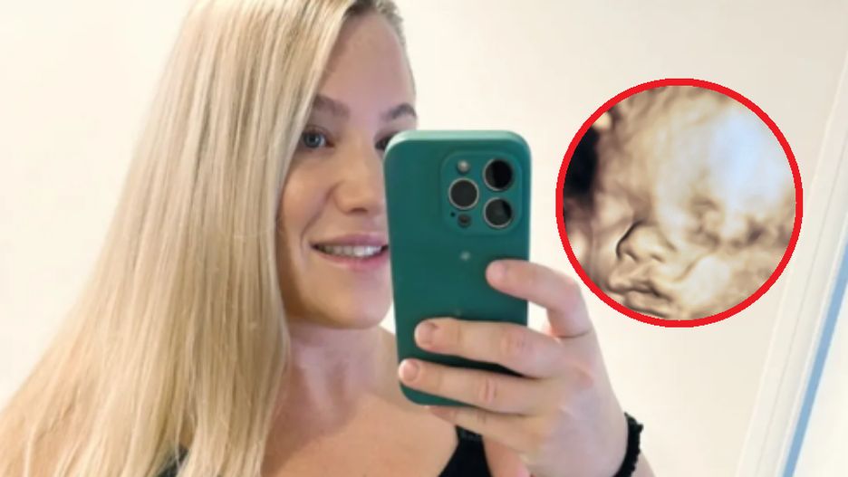 Straciła jedno z bliźniąt. Postanowiła walczyć o drugie dziecko, choć grozi jej rak