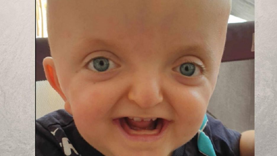 Leoś Szczepaniak potrzebuje wielu kosztownych operacji