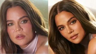 Khloe Kardashian przesadziła z retuszowaniem zdjęć? Internauci grzmią: "To są dwie ZUPEŁNIE RÓŻNE osoby"