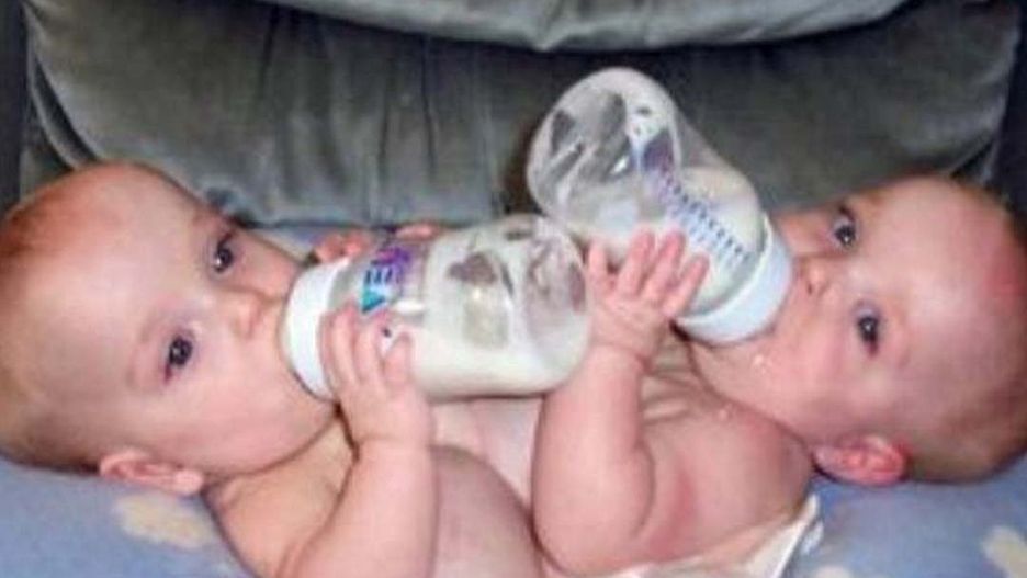 Były zrośnięte, kiedy matka oddała je do adopcji. Tak dzisiaj wyglądają