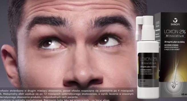 „I masz zakola z głowy” w reklamie Loxon 2% (wideo)