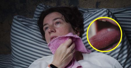Objawem jest malinowy język. Od początku roku już 32 tys. zachorowań