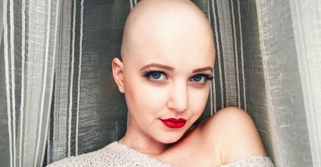 Claudia - jej choroba, skutki chemioterapii, pomoc od psychologa, "Pochłonięta" inspiruje