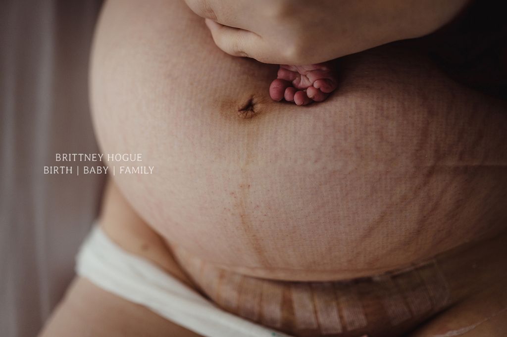 Najlepsze zdjęcia z porodu: Birth Photography Image Competition 2020 6
