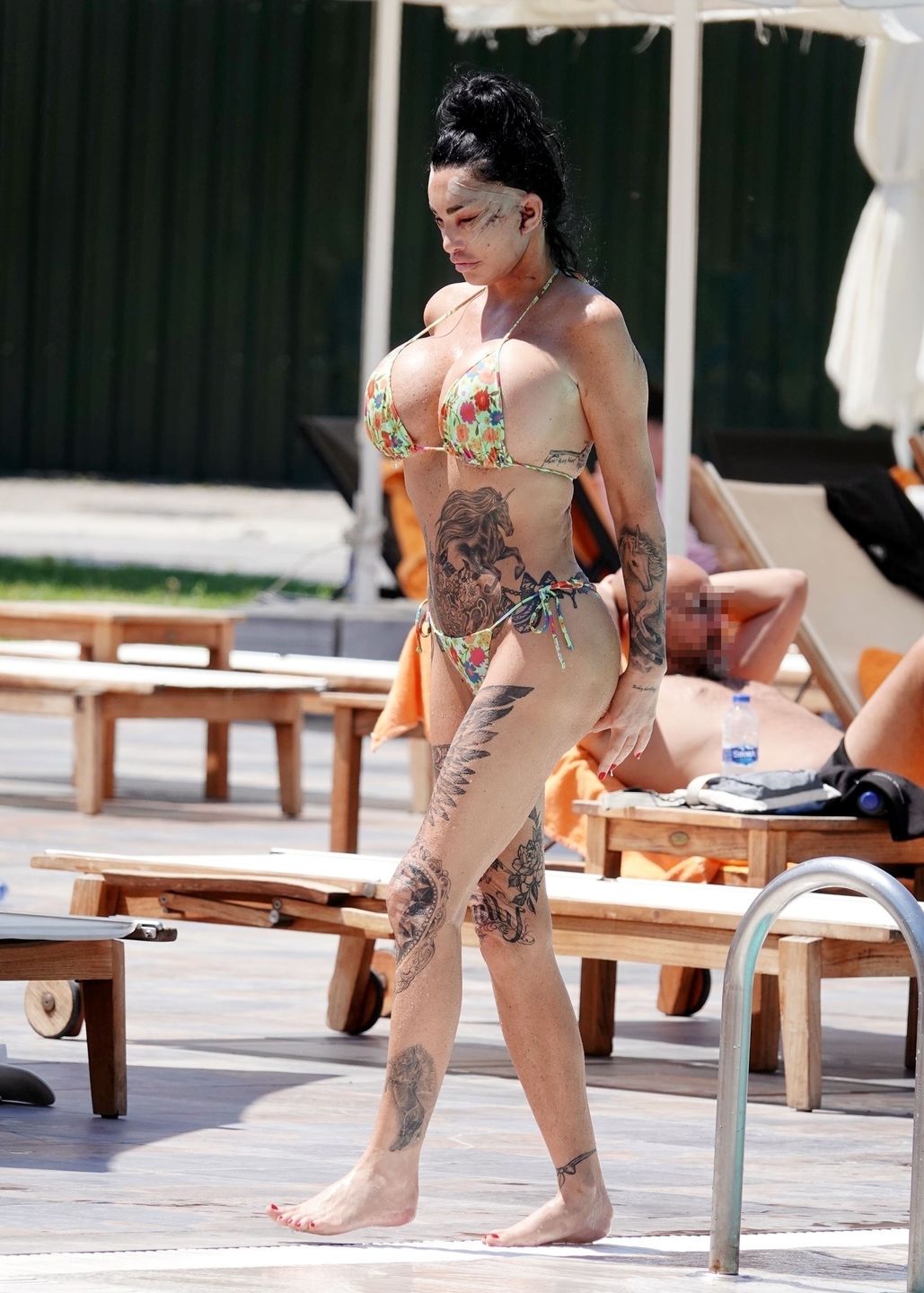 Katie Price w bikini. Pokazała się świeżo po operacji plastycznej