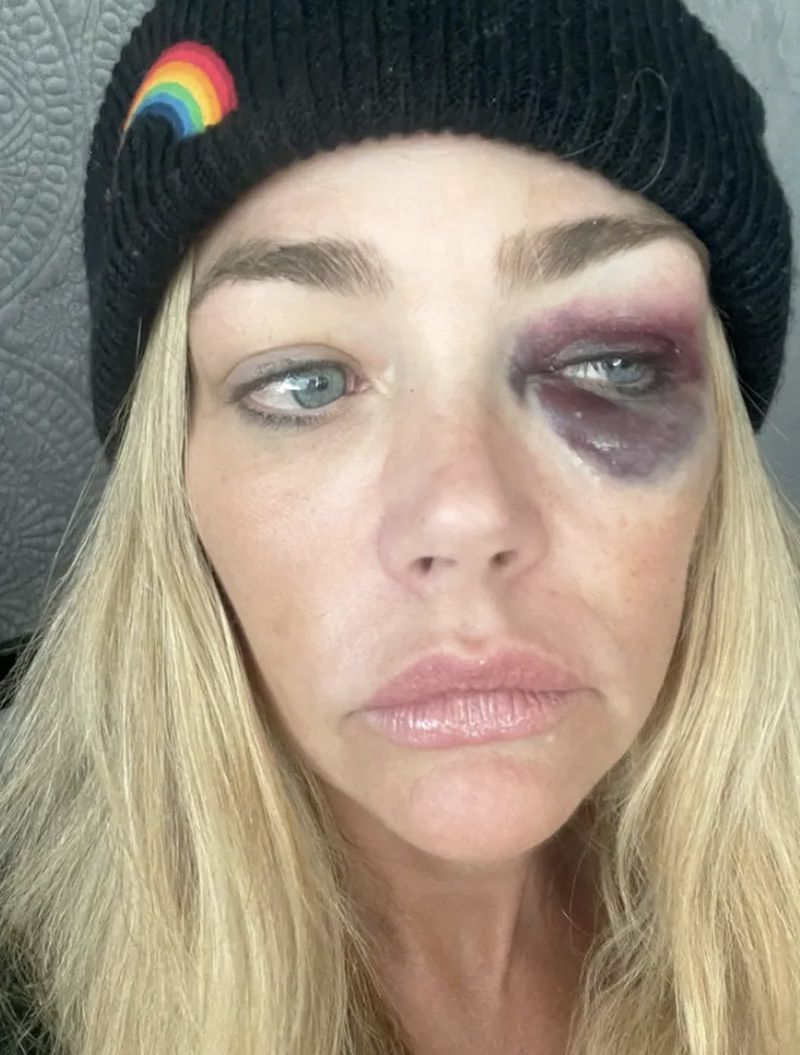 Denise Richards oskarża męża o przemoc