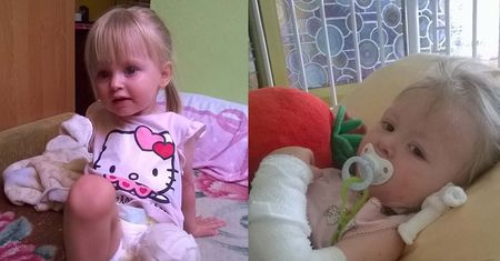 2-letnia Natalka z Puław straciła nogę przez pijanego kierowcę. Teraz potrzebuje pomocy
