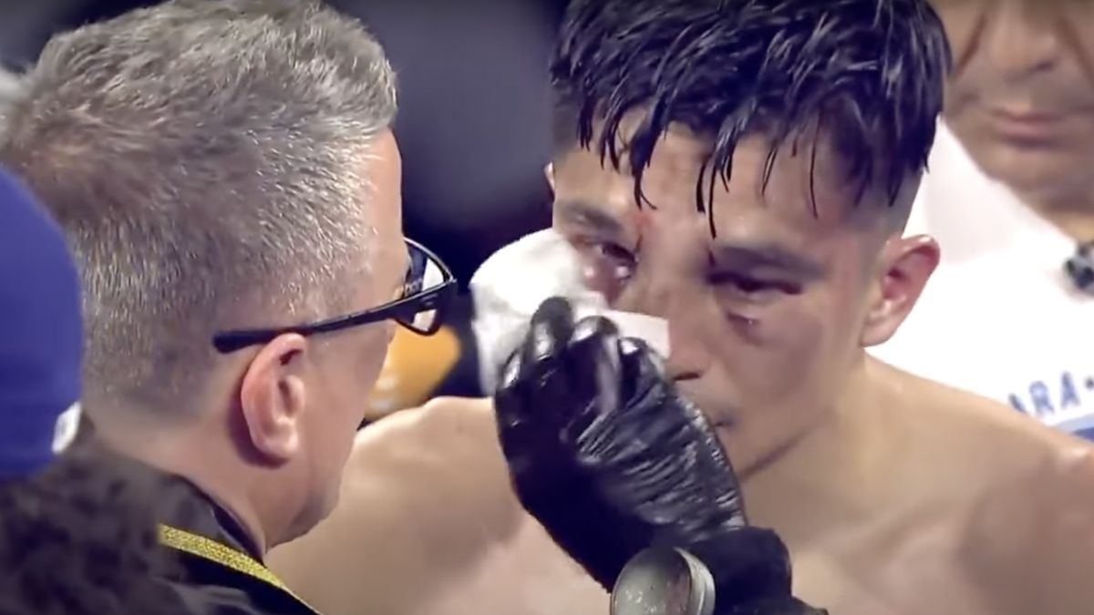 Kontuzja Joeta Gonzaleza 