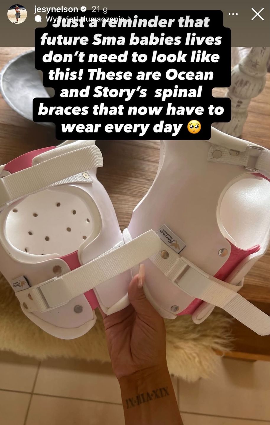 Jesy Nelson pokazała gorsety ortopedyczne córek