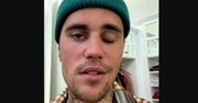 Justin Bieber ma sparaliżowaną twarz. Jest diagnoza lekarzy