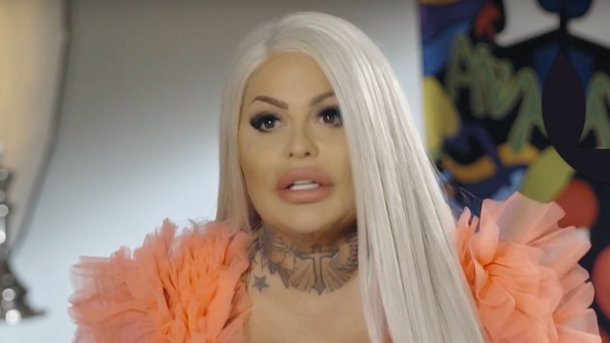 Laluna z "Królowych życia" o operacji bariatrycznej