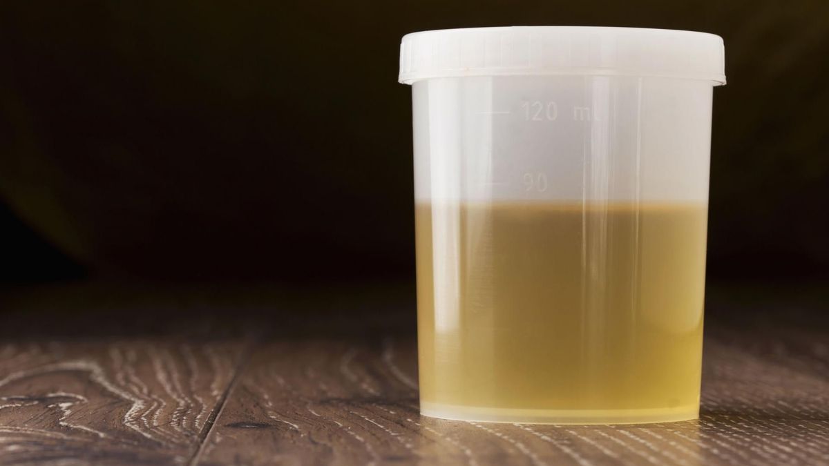 Erytrocyty w moczu może wykazać badanie ogólne moczu