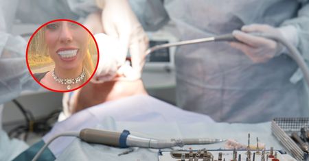 Influencerka pokazała "tureckie zęby". Wideo stało się viralem