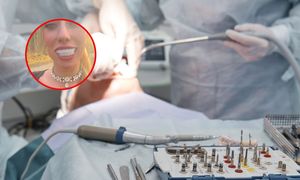 Influencerka zrobiła zęby w Turcji. Pokazała, jak teraz wygląda