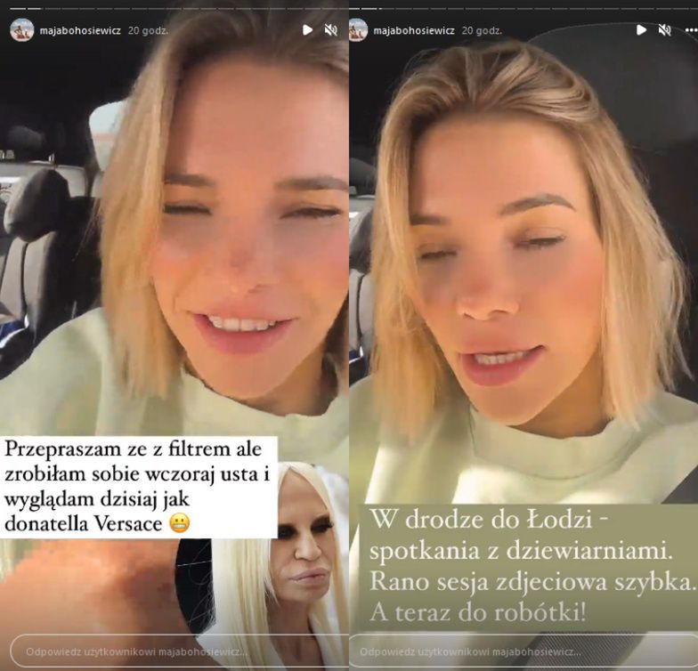 Maja Bohosiewicz powiększyła usta w Polsce