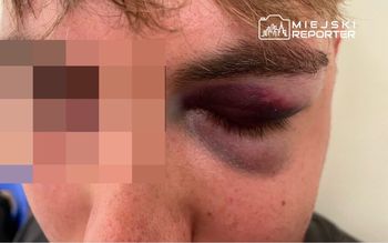 Brutalne pobicie na Bulwarach Wiślanych pod Centrum Nauki Kopernik. 27-latek doznał poważnych obrażeń. Sprawcy poszukiwani