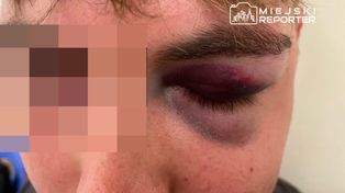 Brutalne pobicie na Bulwarach Wiślanych pod Centrum Nauki Kopernik. 27-latek doznał poważnych obrażeń. Sprawcy poszukiwani