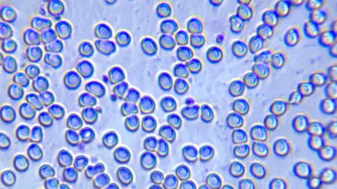 Dzięki DIPLE podejrzysz swoje czerwone krwinki przez aparat w telefonie 1