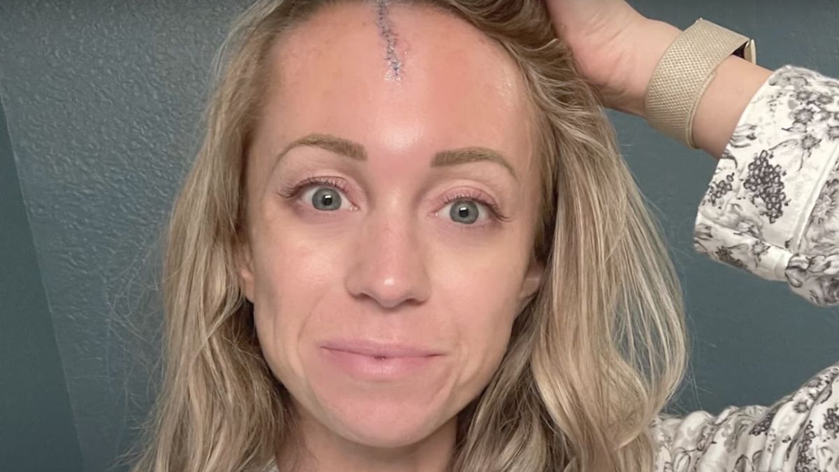 Kelsey Wingert mocno ucierpiała podczas meczu 