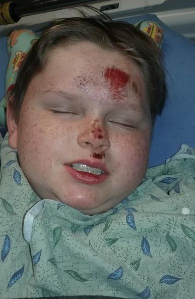 Chłopiec był w ciężkim stanie