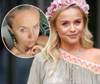 Pokazała zdjęcia po usunięciu toksycznej substancji z piersi. Jej ciało jest okaleczone