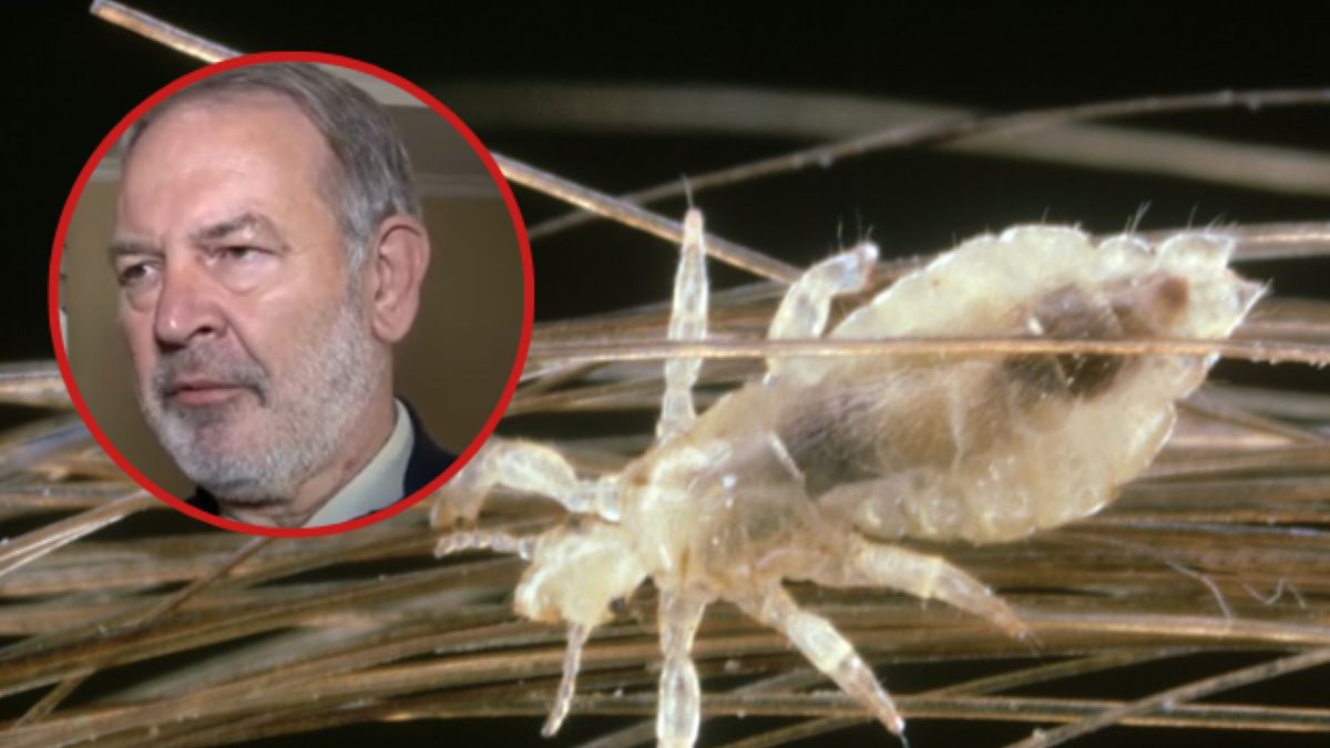 prof. Stanisław Ignatowicz wyjaśnia "wszy zostaną z nami zawsze"