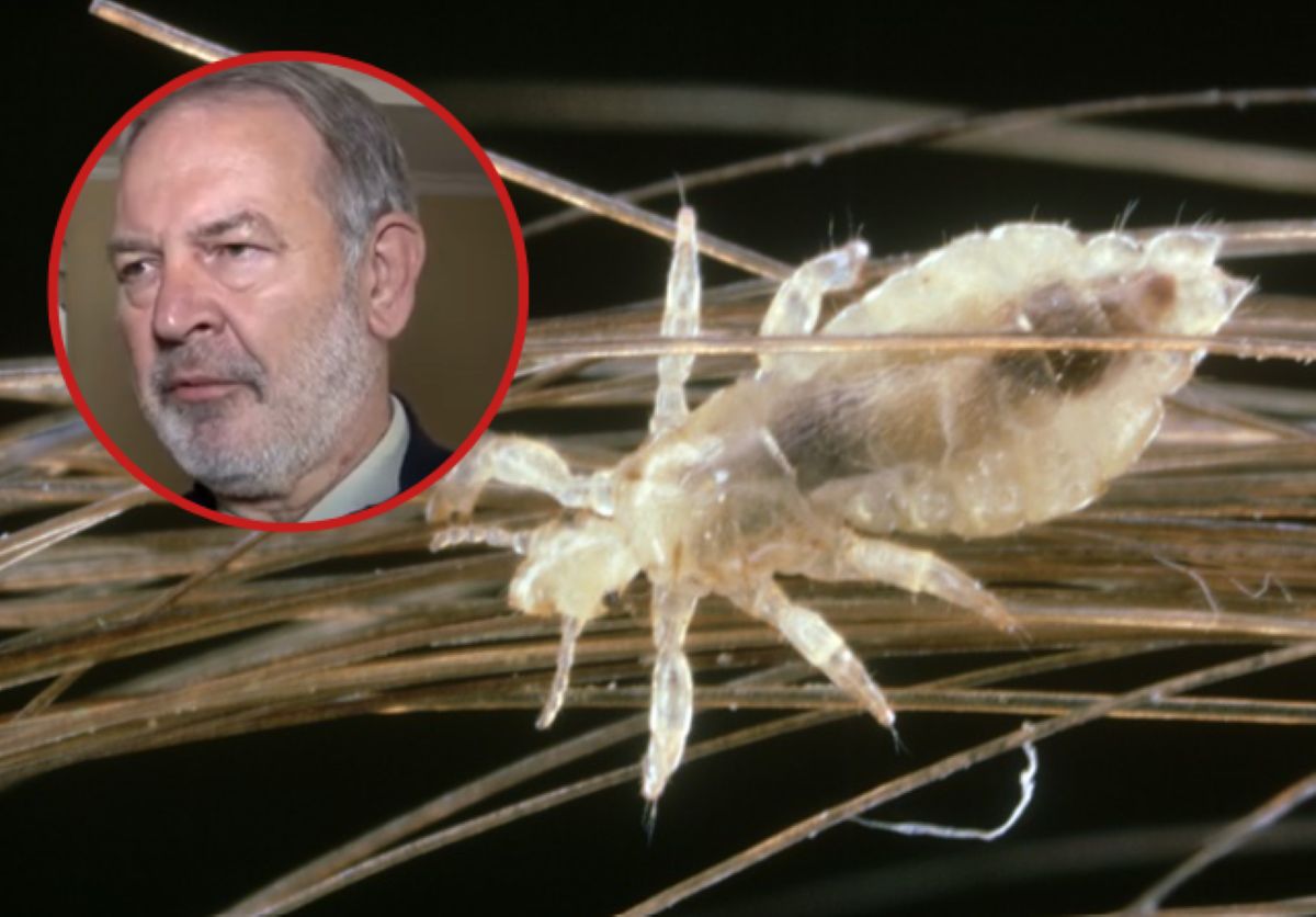 Ekspert nie ma wątpliwości. "Tam, gdzie są ludzie — tam będą i wszy"