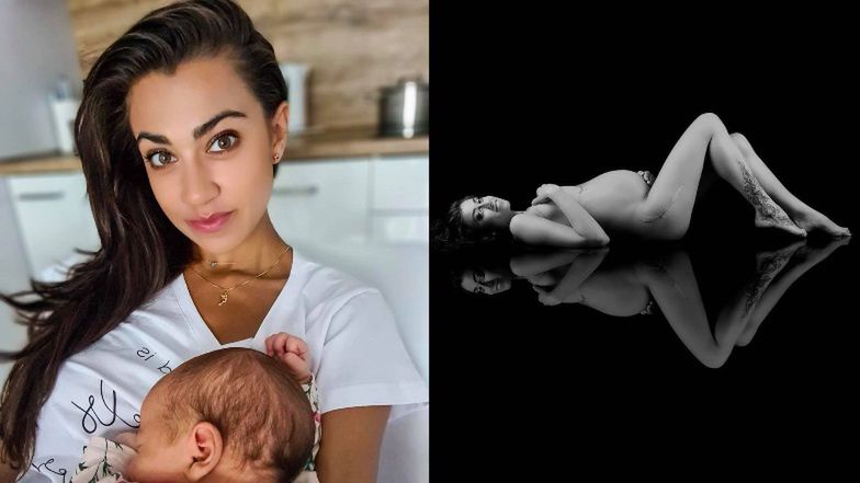 Maja Hyży pokazała bliznę