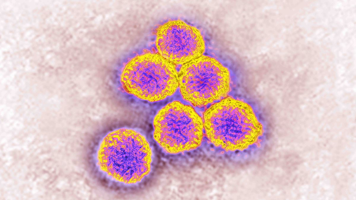 Wirus gorączki Zachodniego Nilu. Pierwszy przypadek w Polsce