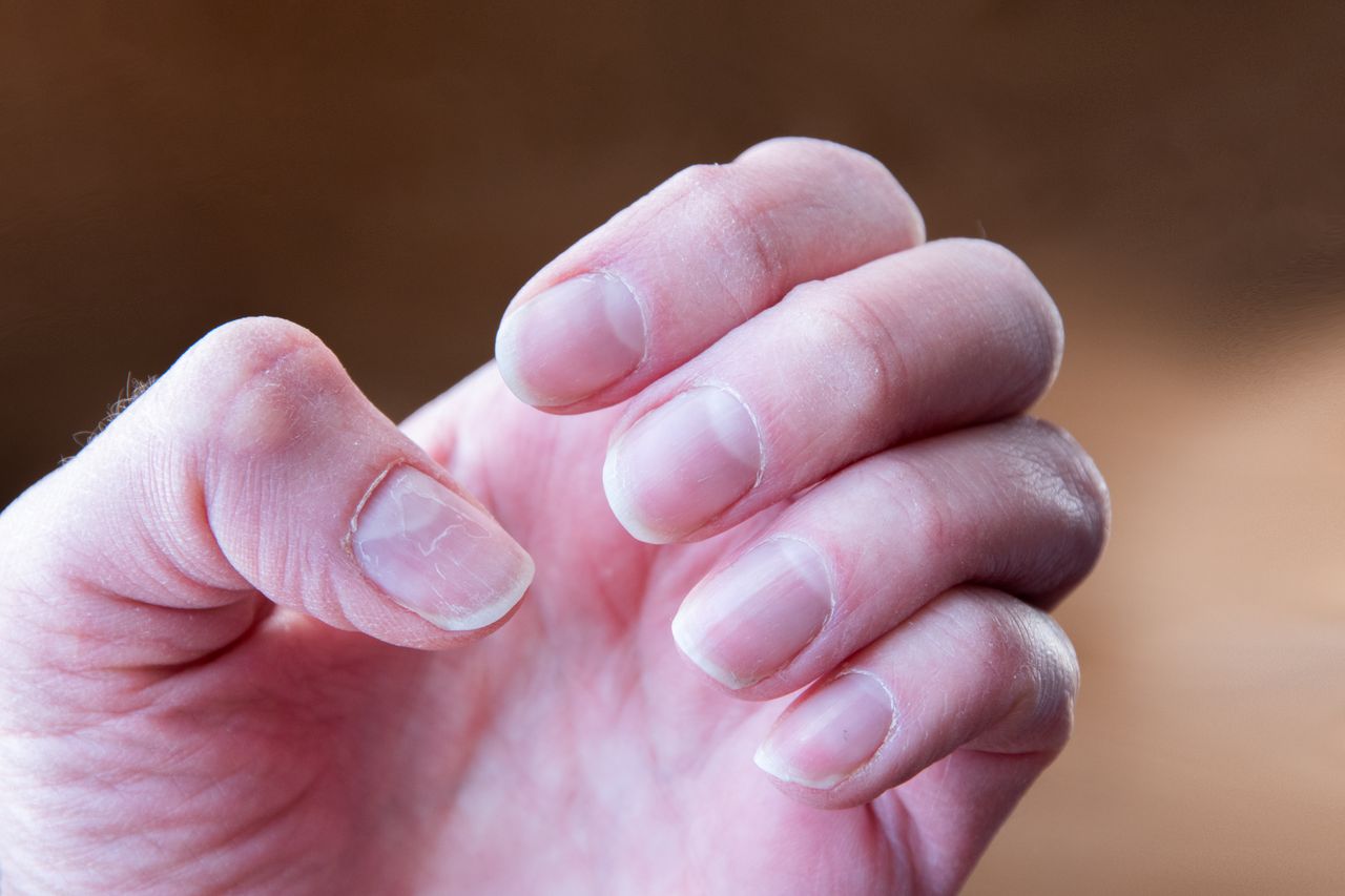 Natural methods to achieve strong, healthy nails at home