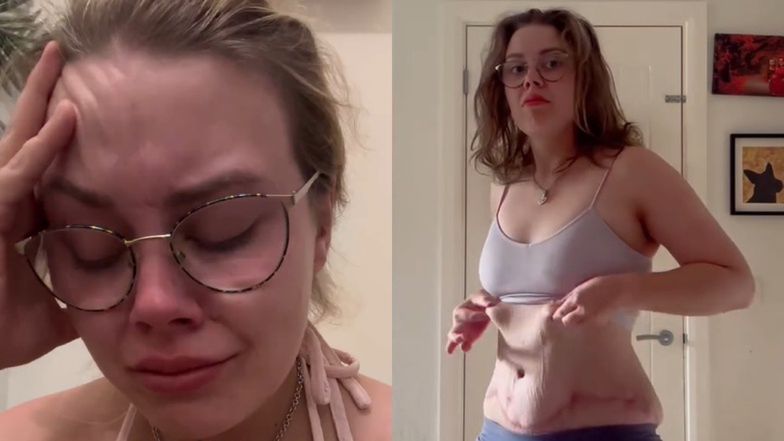 Zrozpaczona 26-latka opowiedziała w internecie o swojej operacji