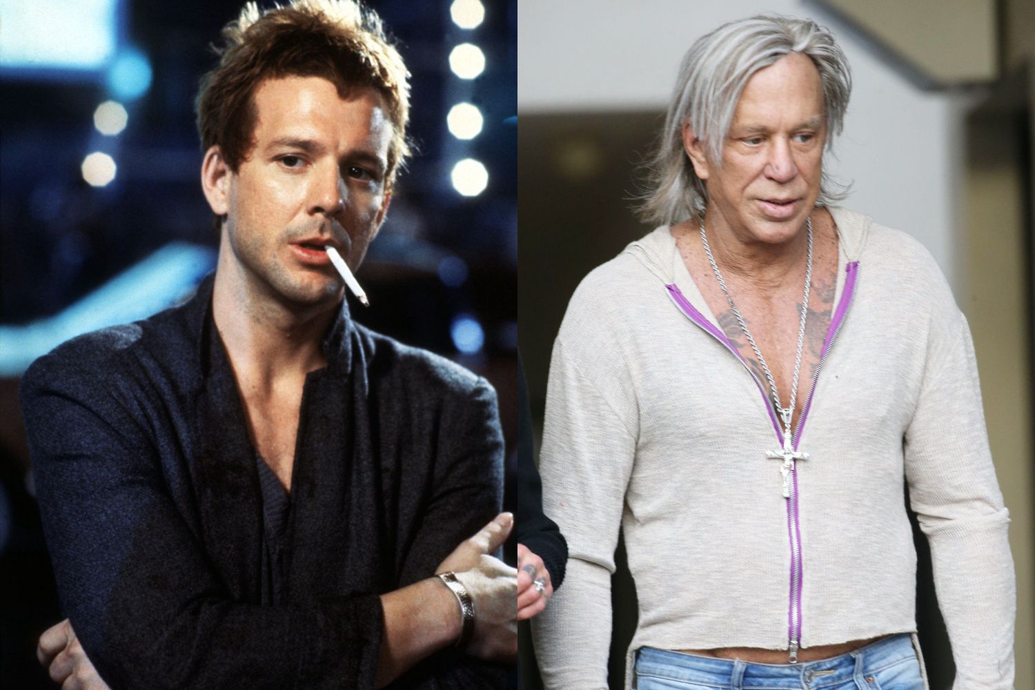 Mickey Rourke i operacje plastyczne