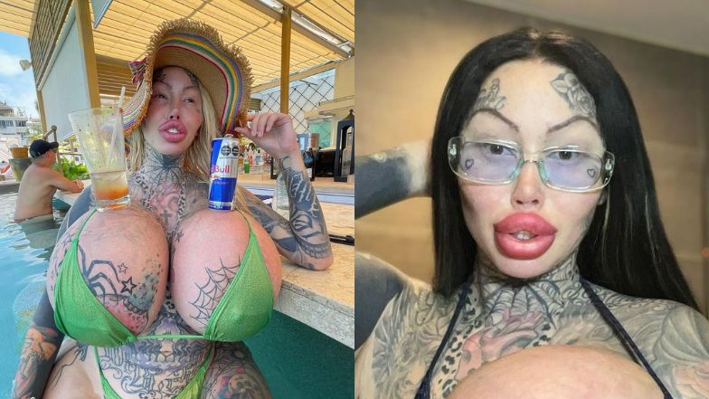 Instagramowej modelce wybuchł implant piersi. Ważył 10 kg