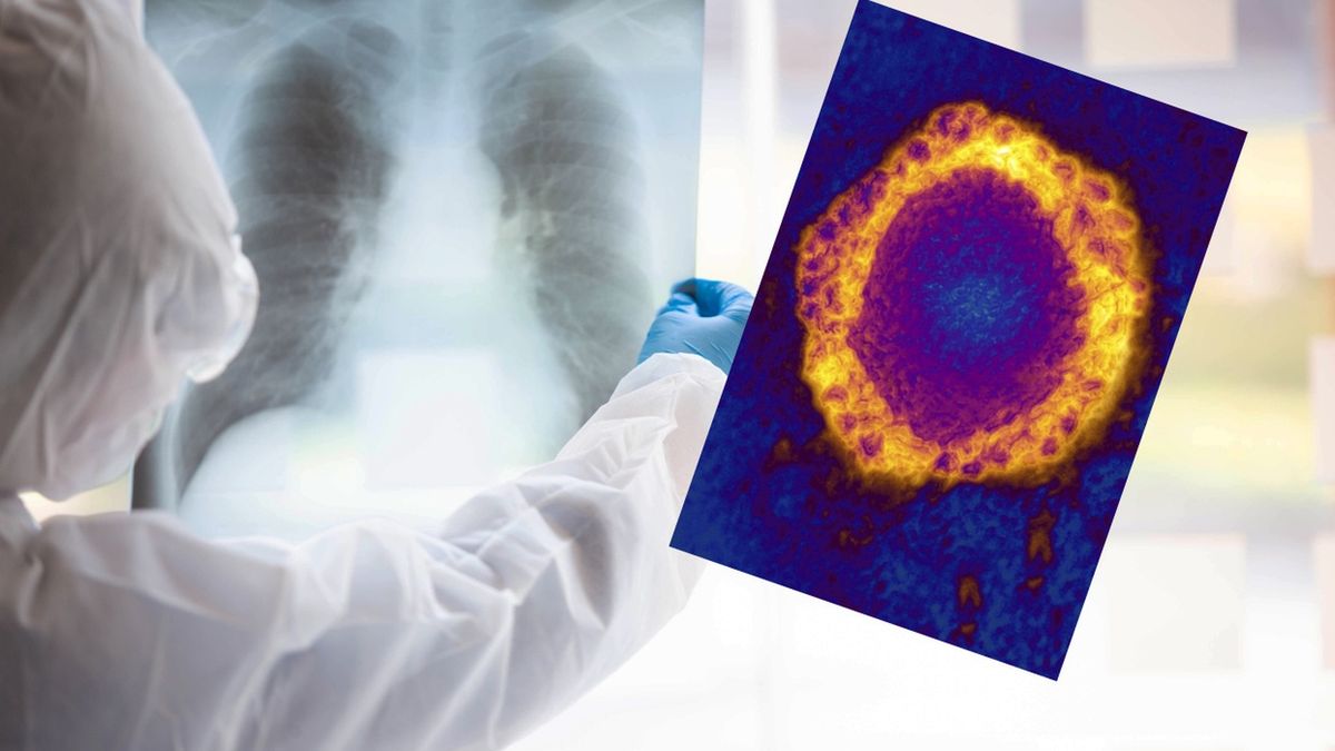 Koronawirus. Fatalne wieści z USA