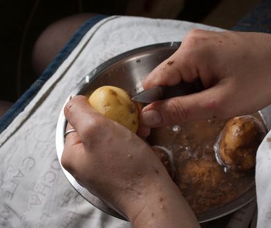 Nie jedz takich ziemniaków. Są trujące