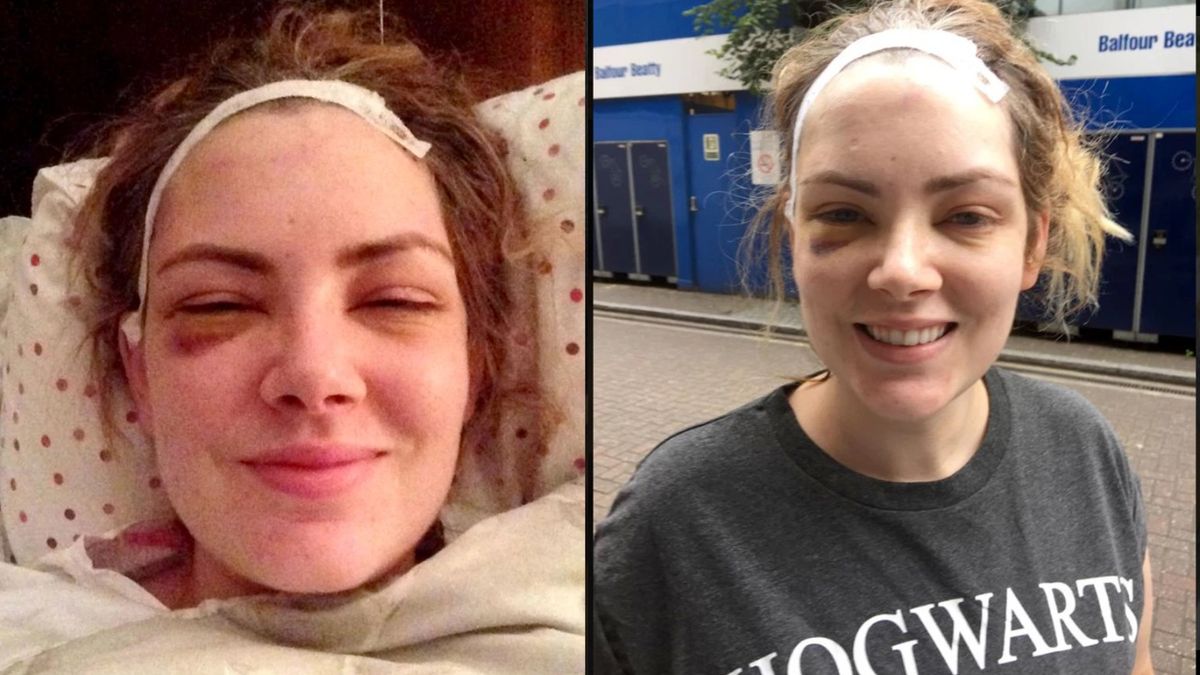 Emily Corrigan myślała, że jest zmęczona opieką nad dziećmi. Okazało się, że to objawy guza mózgu - gwiaździaka