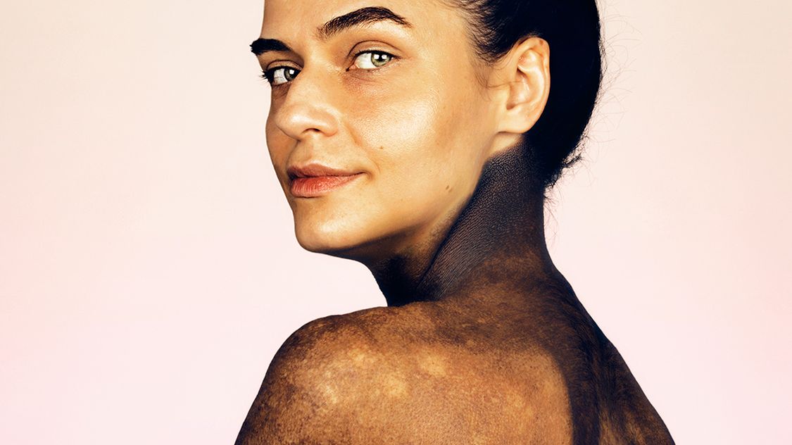 Piękni dzięki znamionom, nie pomimo nich. Rusza wystawa wyjątkowych portretów 1