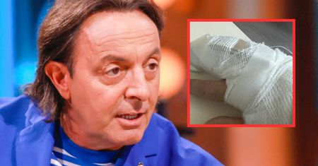 Michel Moran miał wypadek. Pokazał zdjęcie obrażeń. Co z jego pracą?