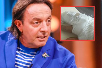 Michel Moran miał wypadek. Pokazał zdjęcie palca